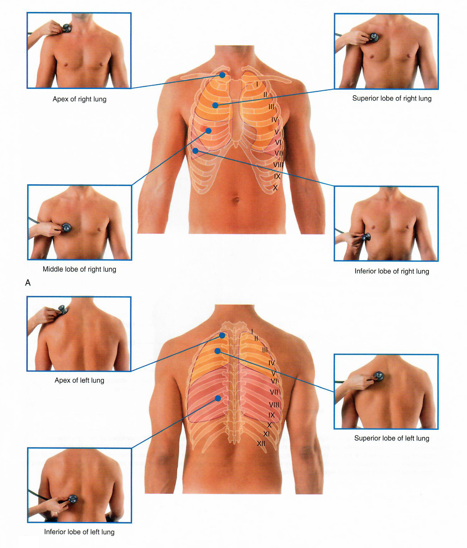 Lung Sounds